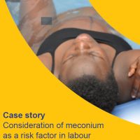 Read more: Consideration of meconium as a risk factor in labour